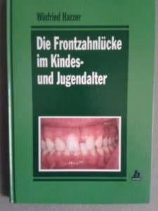 Harzer, W. (1993): Die Frontzahnlücke im Kindes- und Jugendalter